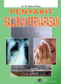 Image of Penyakit Saluran Pernapasan