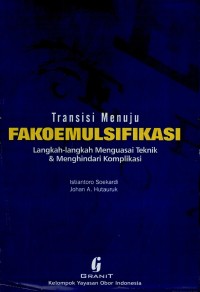 Image of Transisi Menuju Fakoemulsifikasi